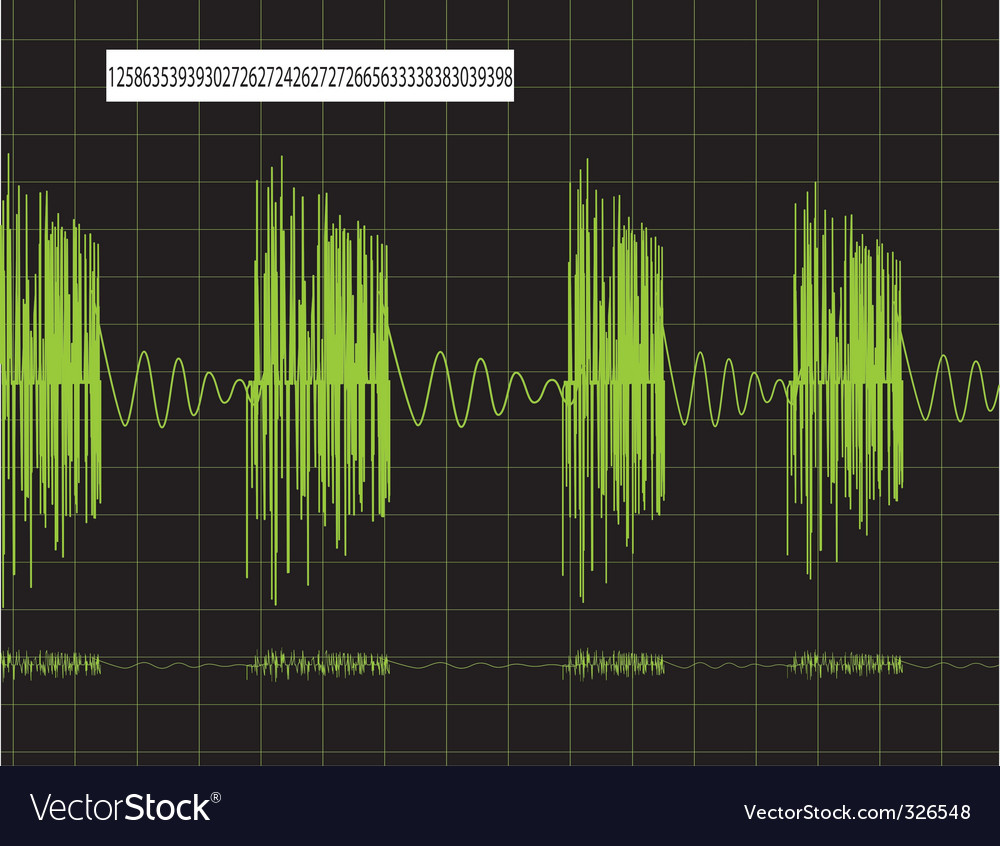 Dynamic Pulse Display