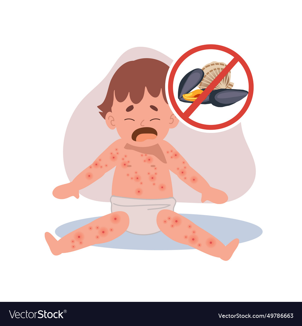 Allergic reactions in infants baby with skin rash