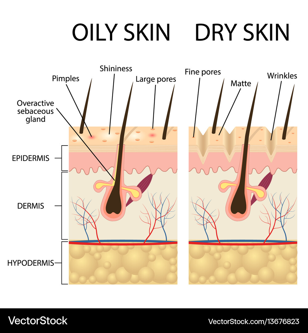 Human skin types and conditions Royalty Free Vector Image