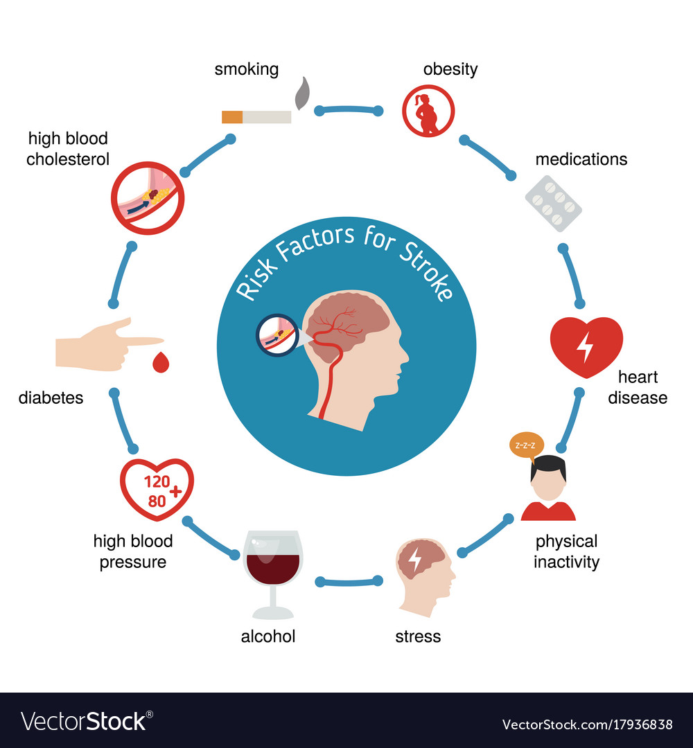Infographics For Stroke Royalty Free Vector Image Infographics For Stroke Royalty Free Vector Image