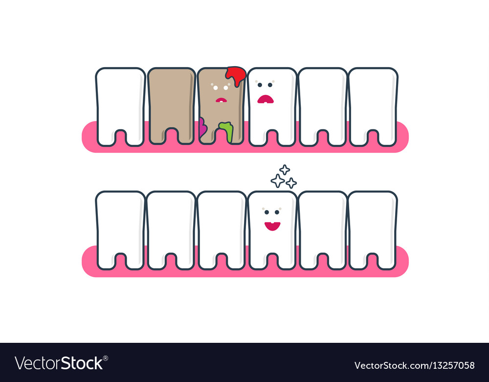 Teeth icons before and after bleaching