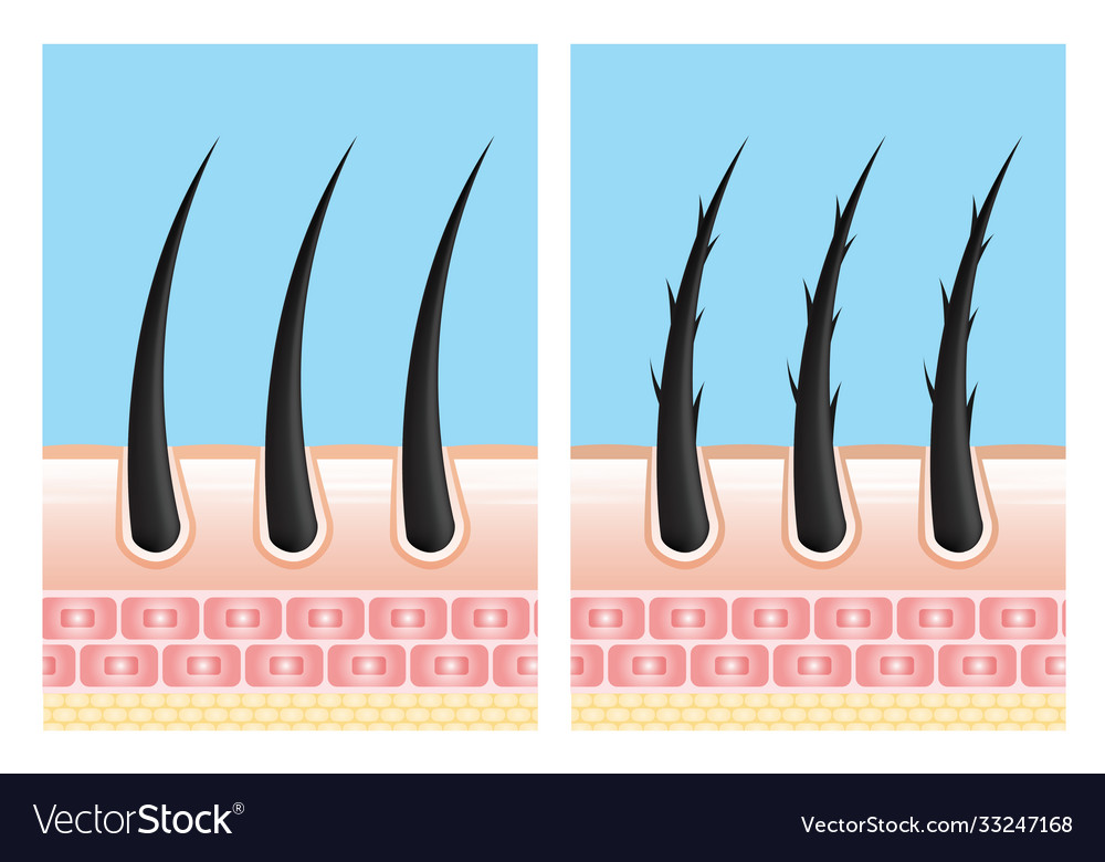 Hair care serum follicle diagnostics anatomy skin Vector Image