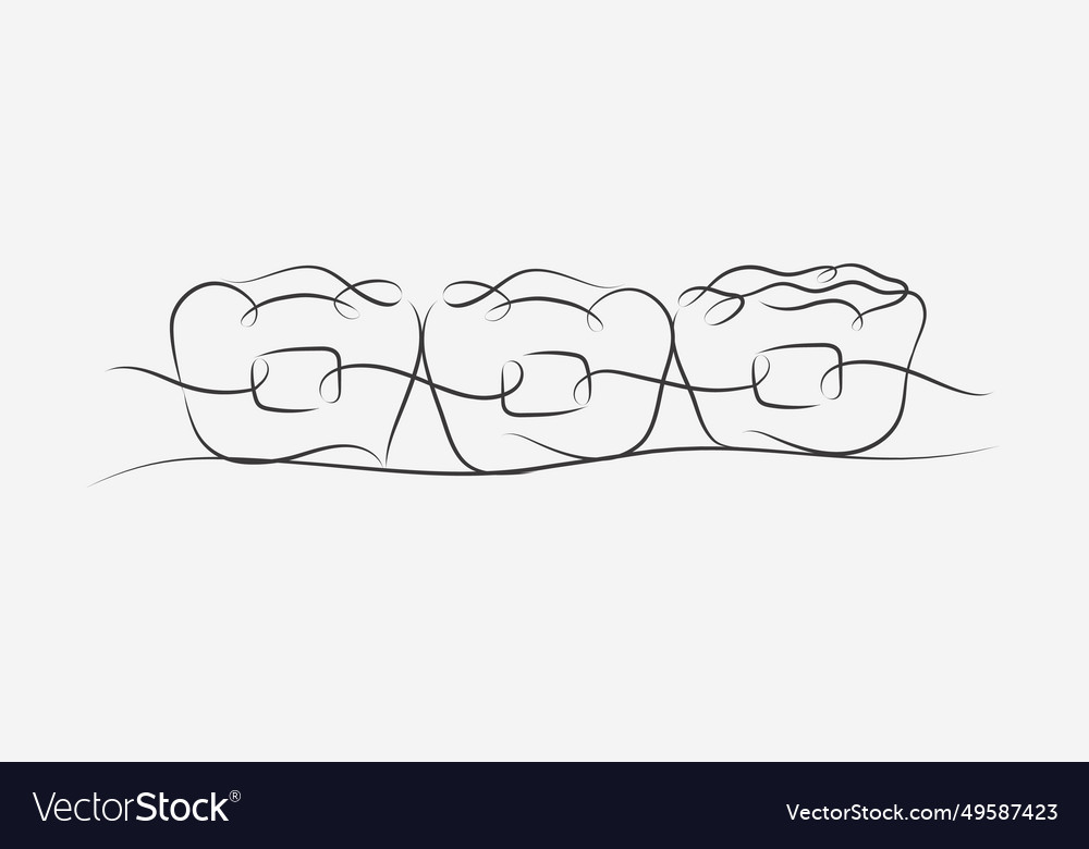 Teeth Braces Drawing In Linear Style On White Vector Image