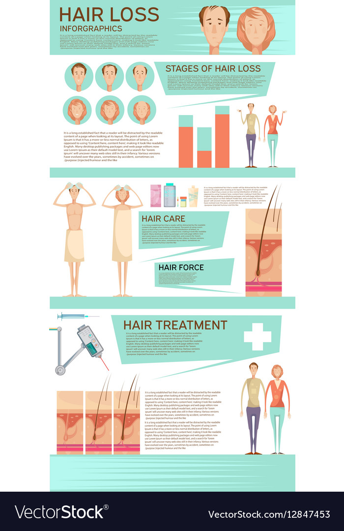 Hair Loss Infographic Poster Royalty Free Vector Image