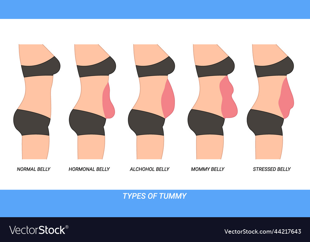 Types of tummies for woman Royalty Free Vector Image