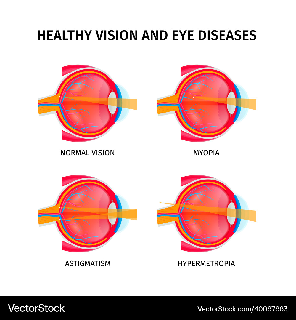 Human eye anatomy set Royalty Free Vector Image