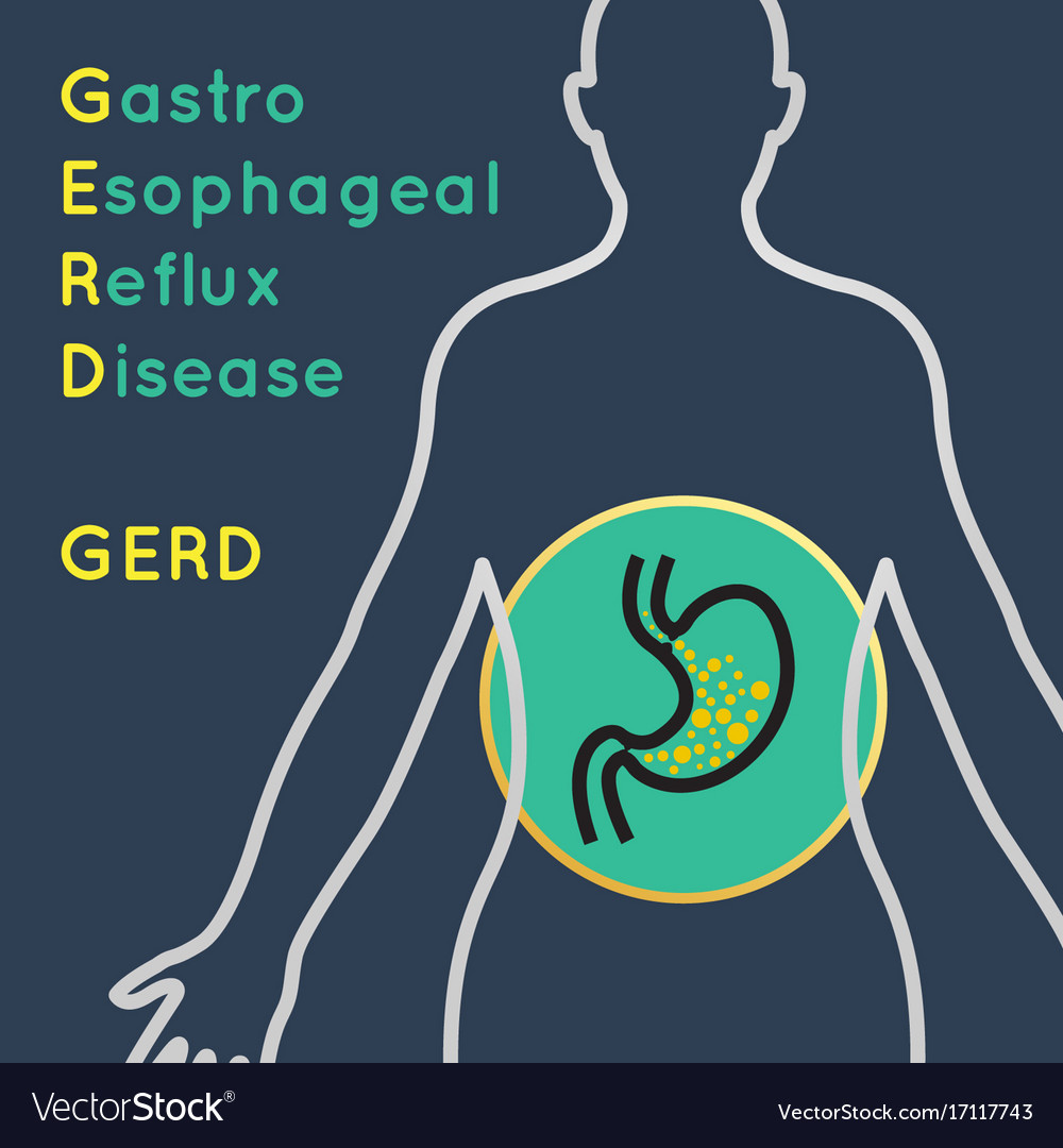 gastroesophageal-reflux-disease-gerd-collection-vector-image