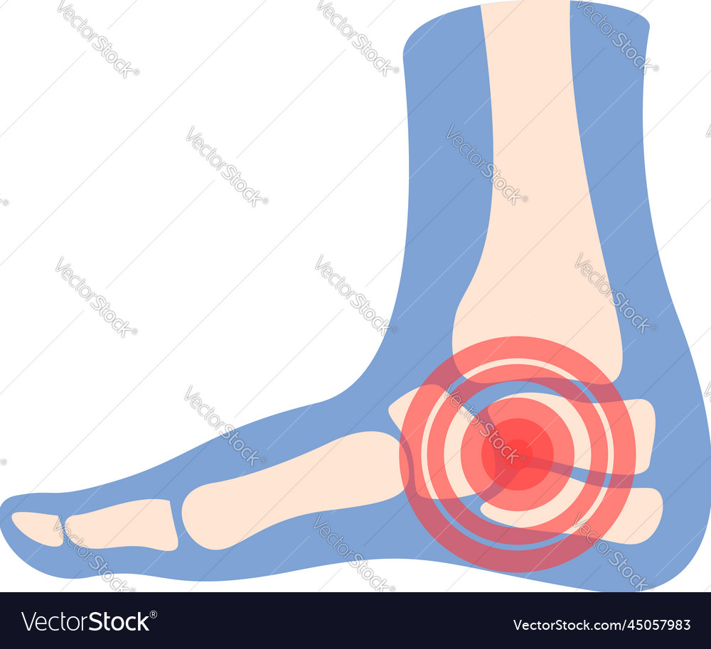 Heel pain icon cartoon arthritis joint Royalty Free Vector