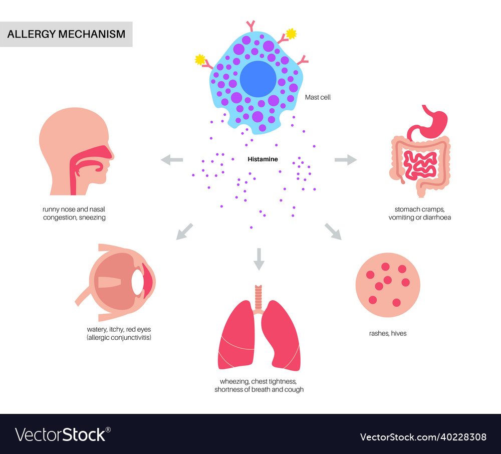 Allergy Symptoms and Mast Cell Mechanism