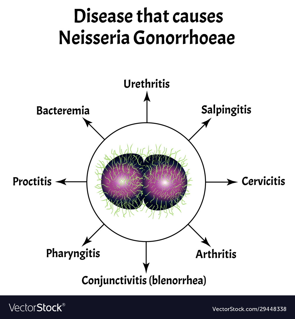 bacterial urethritis conjunctivitis and arthritis
