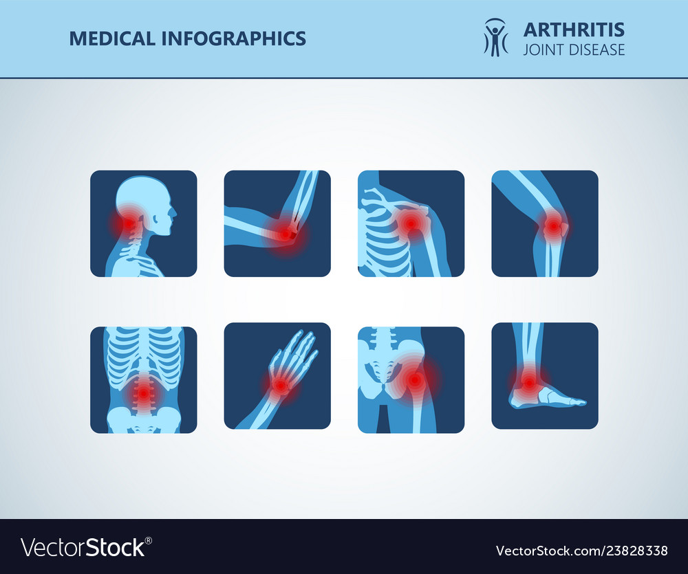 Rheumatism or rheumatic disorder medical set Vector Image