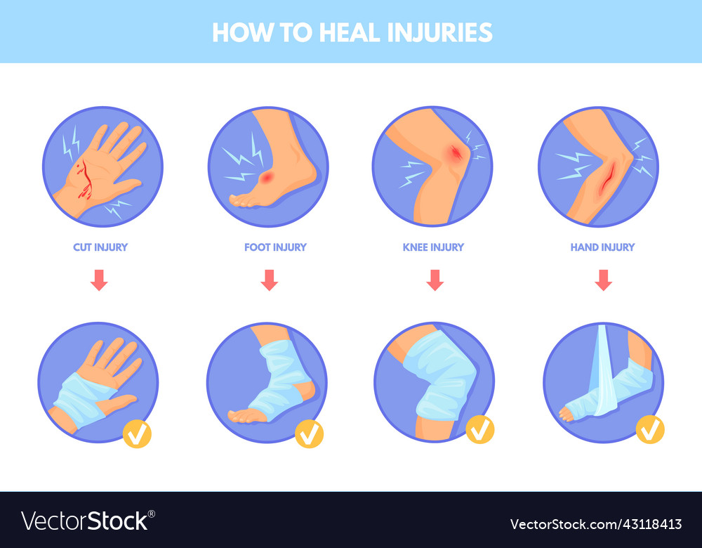 Treatment hurt sport care injury arm leg from