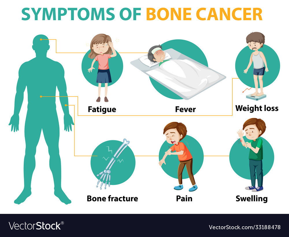 Bone Cancers Hidden Sign Swelling You Should Know - 9pybh8t