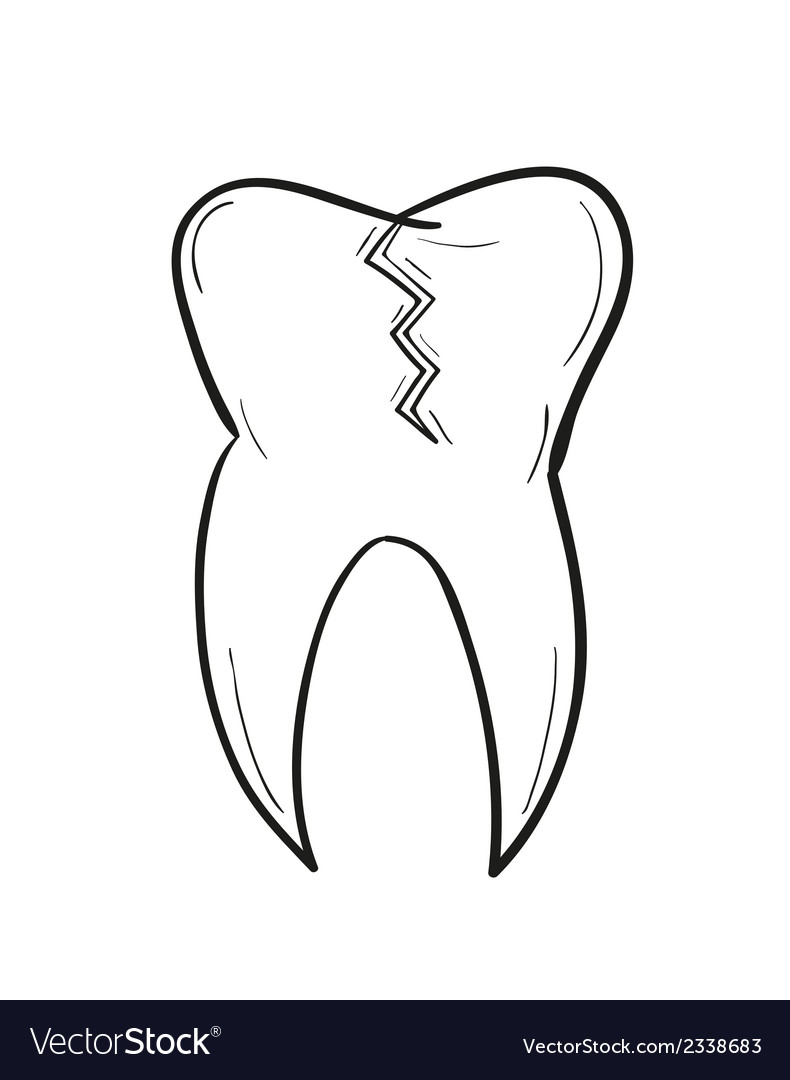 Sketch of the tooth with defect