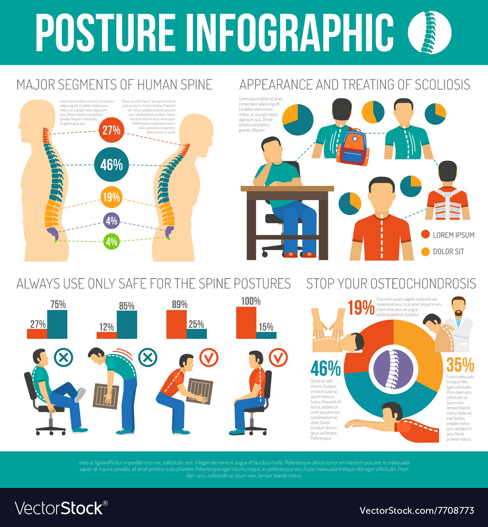 Posture disorders infographics. Flat back posture. The side view