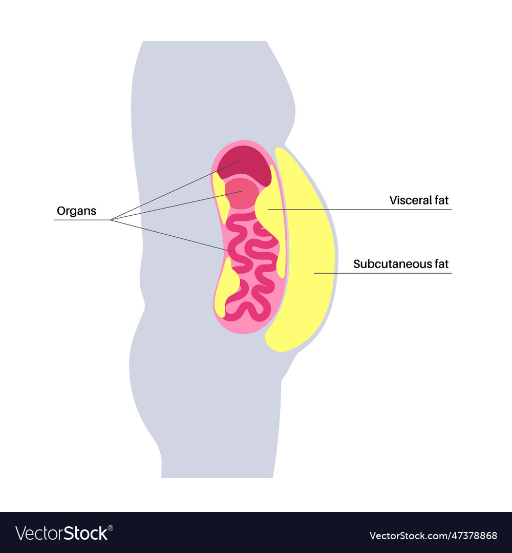 Visceral fat diagram Royalty Free Vector Image