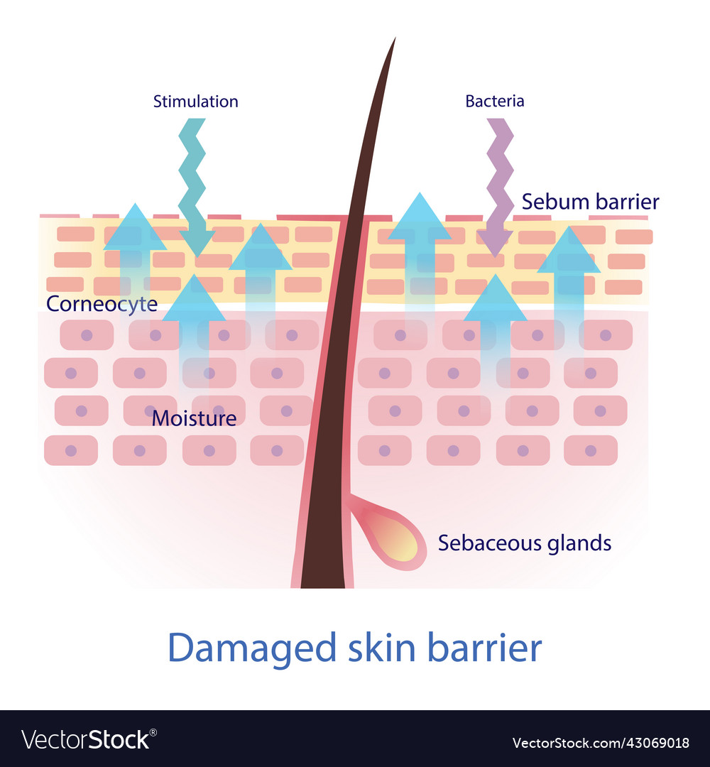 Damaged skin barrier on white background Vector Image