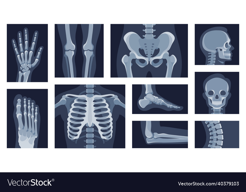 Collection different human body parts roentgen Vector Image