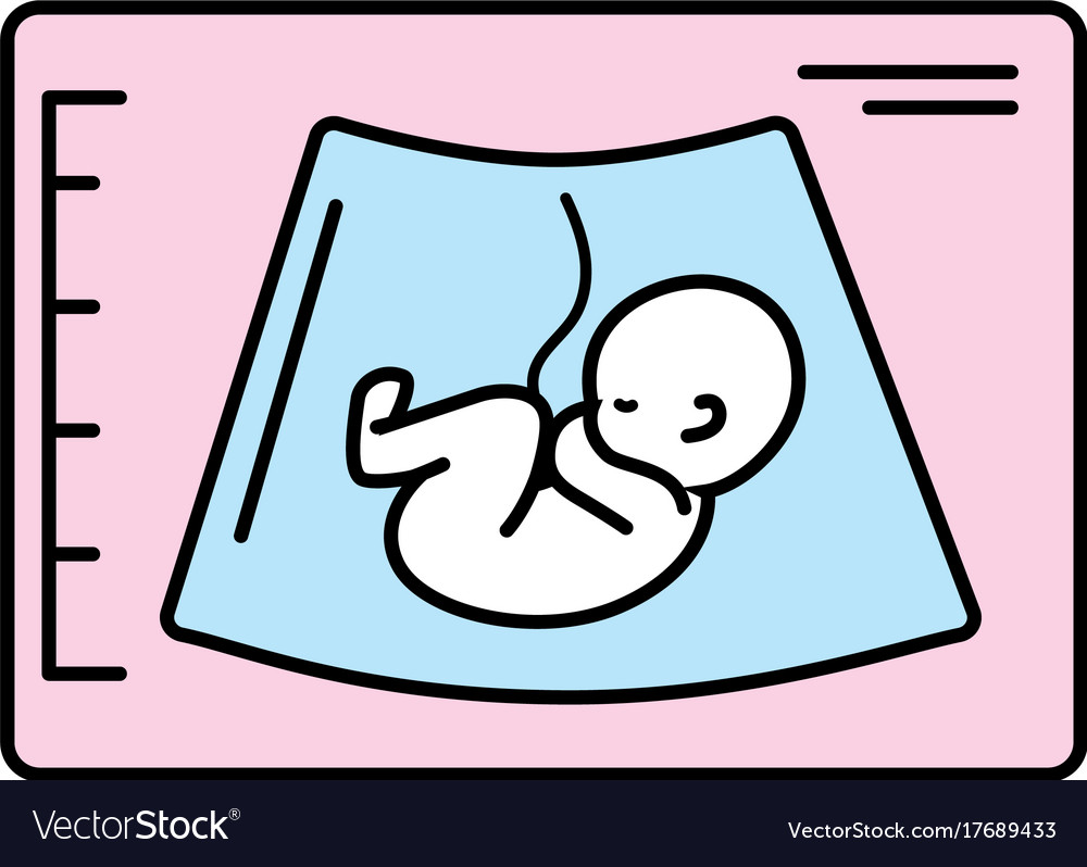 Ultrasound of baby with umbilical cord