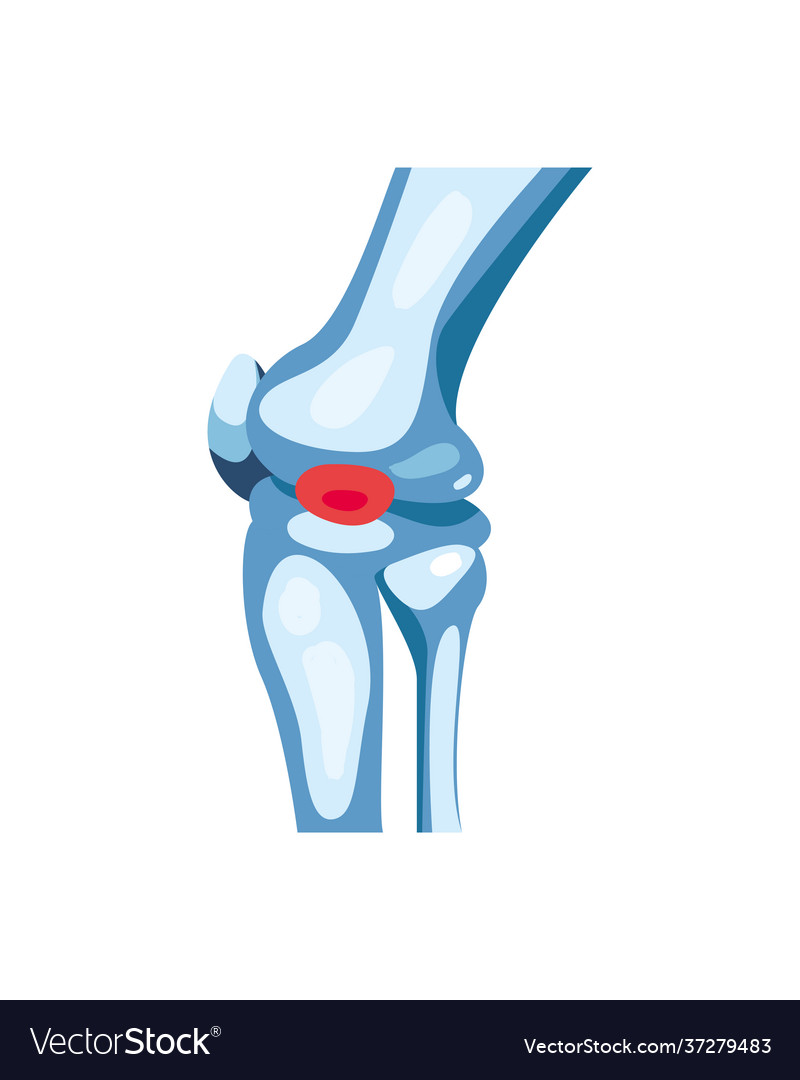 Rheumatology Knee Bones Royalty Free Vector Image