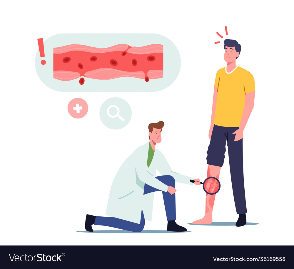 Vessels inflammation rosacea vasculitis concept