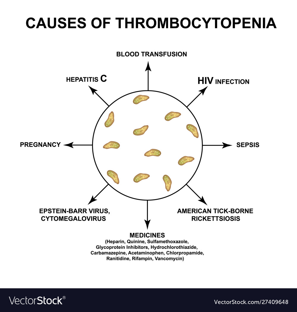 Causes Thrombocytopenia Reducing Platelets In Vector Image