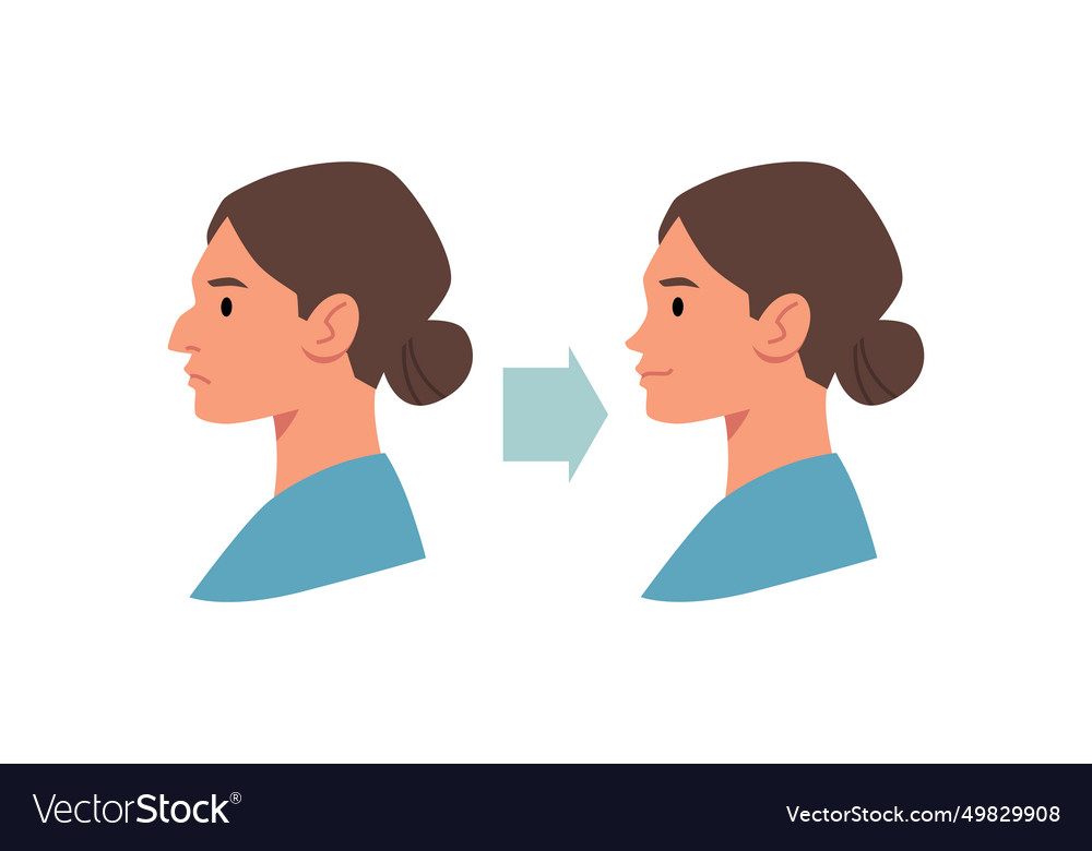 Correction plastic surgery nose reshaping before Vector Image