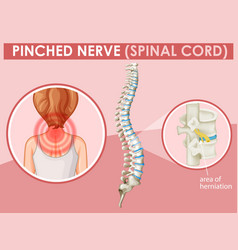 Human nerve cell Royalty Free Vector Image - VectorStock