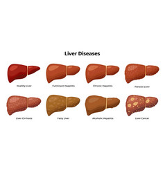 Healthy and unhealthy liver cartoon characters Vector Image