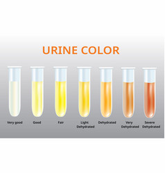 Urine color chart urine in test tubes medical Vector Image