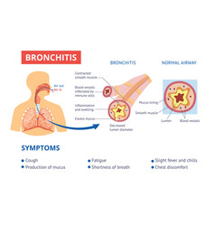 The lungs are healthy and diseased lungs with Vector Image