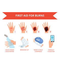 Burns degree first aid for burn wound fire Vector Image