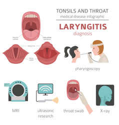 Tonsils and throat diseases laryngitis symptoms Vector Image