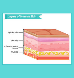 Vitiligo skin cross-section human skin layers Vector Image