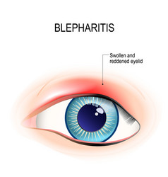 Eyelid Vector Images (over 1,600)