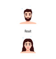 alopecia successful result composition vector image