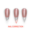 broken or bitting nail correction vector image