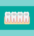 teeth braces flat vector image