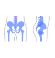 human pelvis anatomy vector image