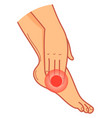 foot pain icon cartoon leg joint injury vector image