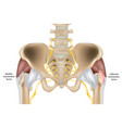 hip trochanteric bursitis is inflammation vector image