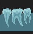 x ray image of teeth dental equipment medical vector image