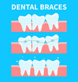 cartoon teeth before vector image vector image